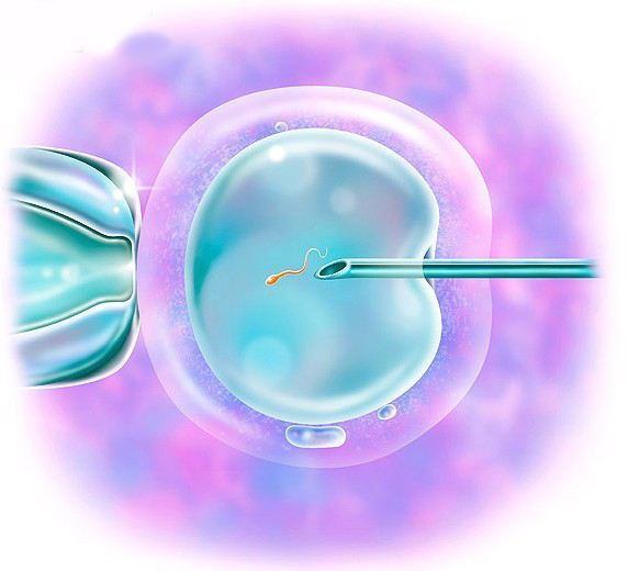 烟台借卵试管助孕-如果试管婴儿的胚胎质量不高，该怎么办？医生：不要太自责