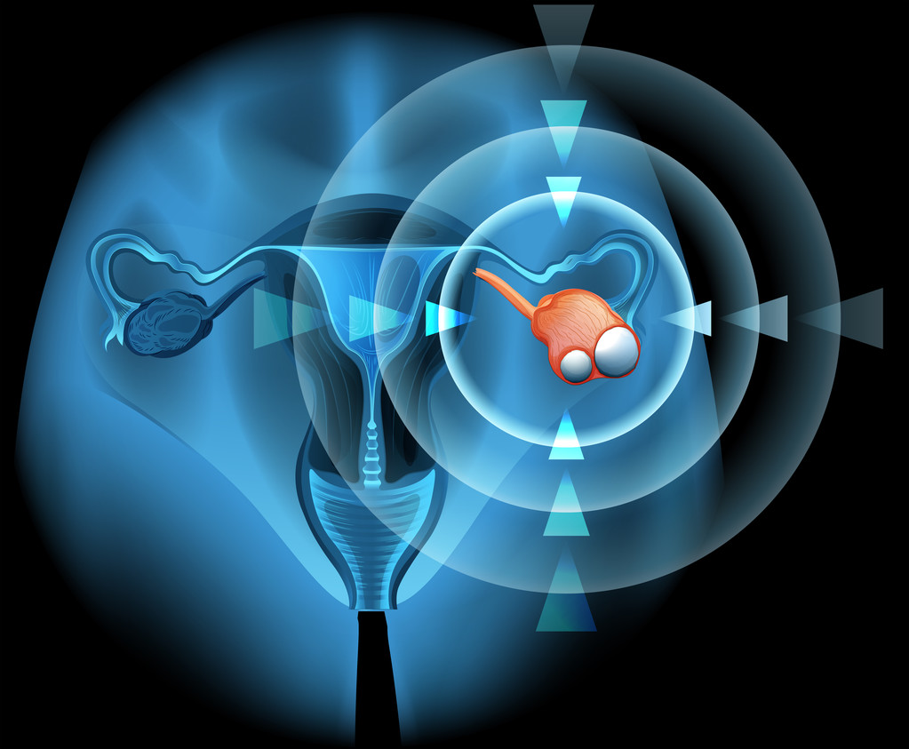 菏泽合法供卵机构-卵巢是女性老龄化的开关