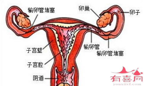 扬州供卵助孕机构-输卵管堵塞的10个迹象--如果你注意到其中三个，你就应该注意了。